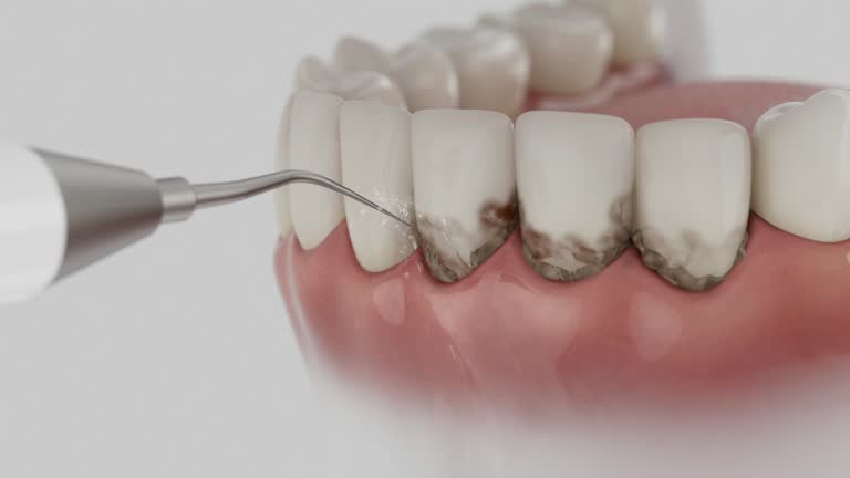Trusted Tooth Extraction service in Carbondale, IL - Dentist Open Now